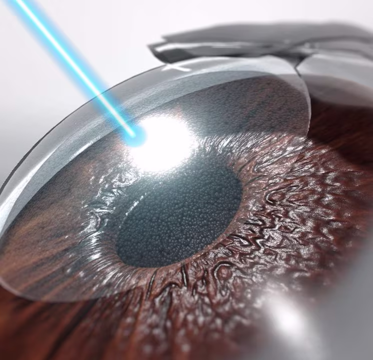 Refractive Services