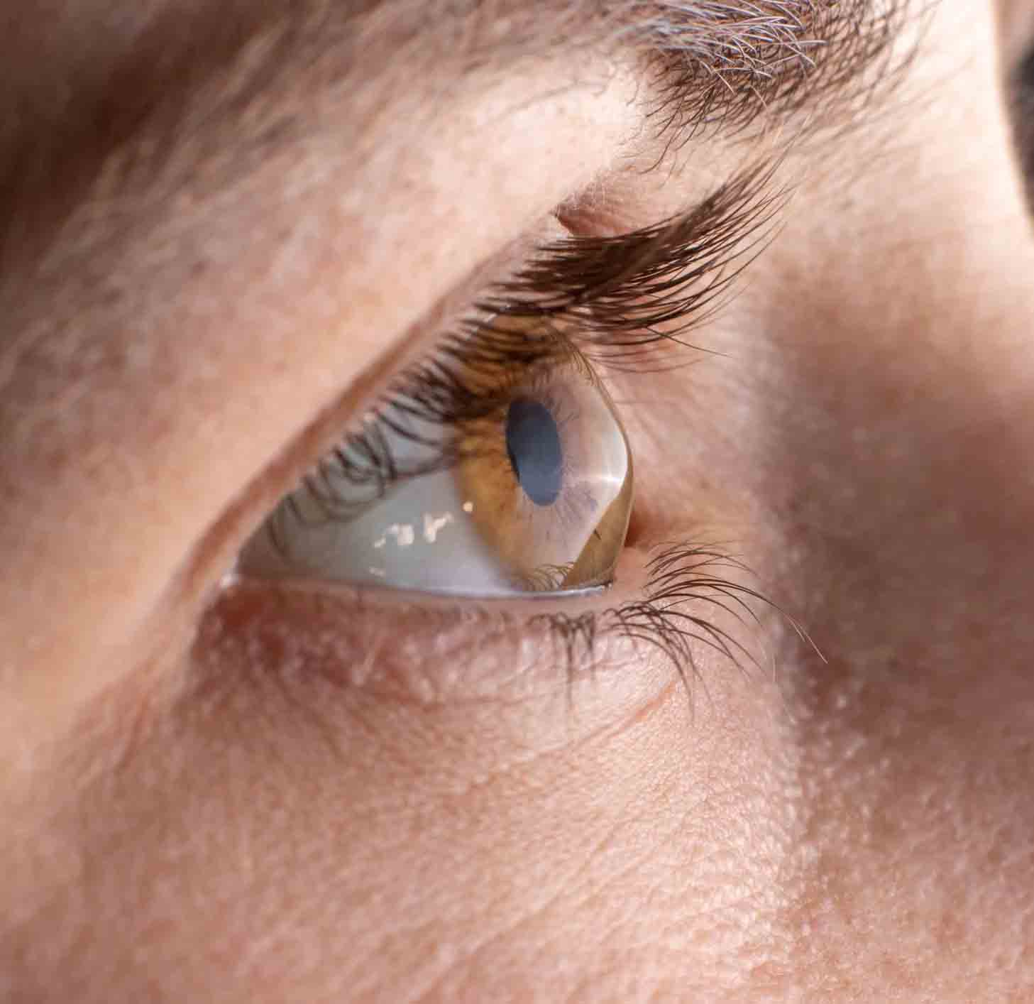 Cornea