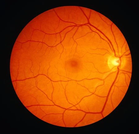 Retina